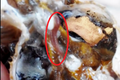 Phát hoảng vì cua đồng chứa vắt